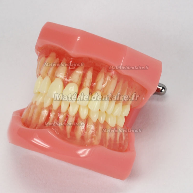 YZDKJDZ Modèle De Dents, Modèle De Dent Orale Orthodontique avec 32 Dents  Amovibles, Modèle De Gencive Molle pour Typodont, pour Démonstration De